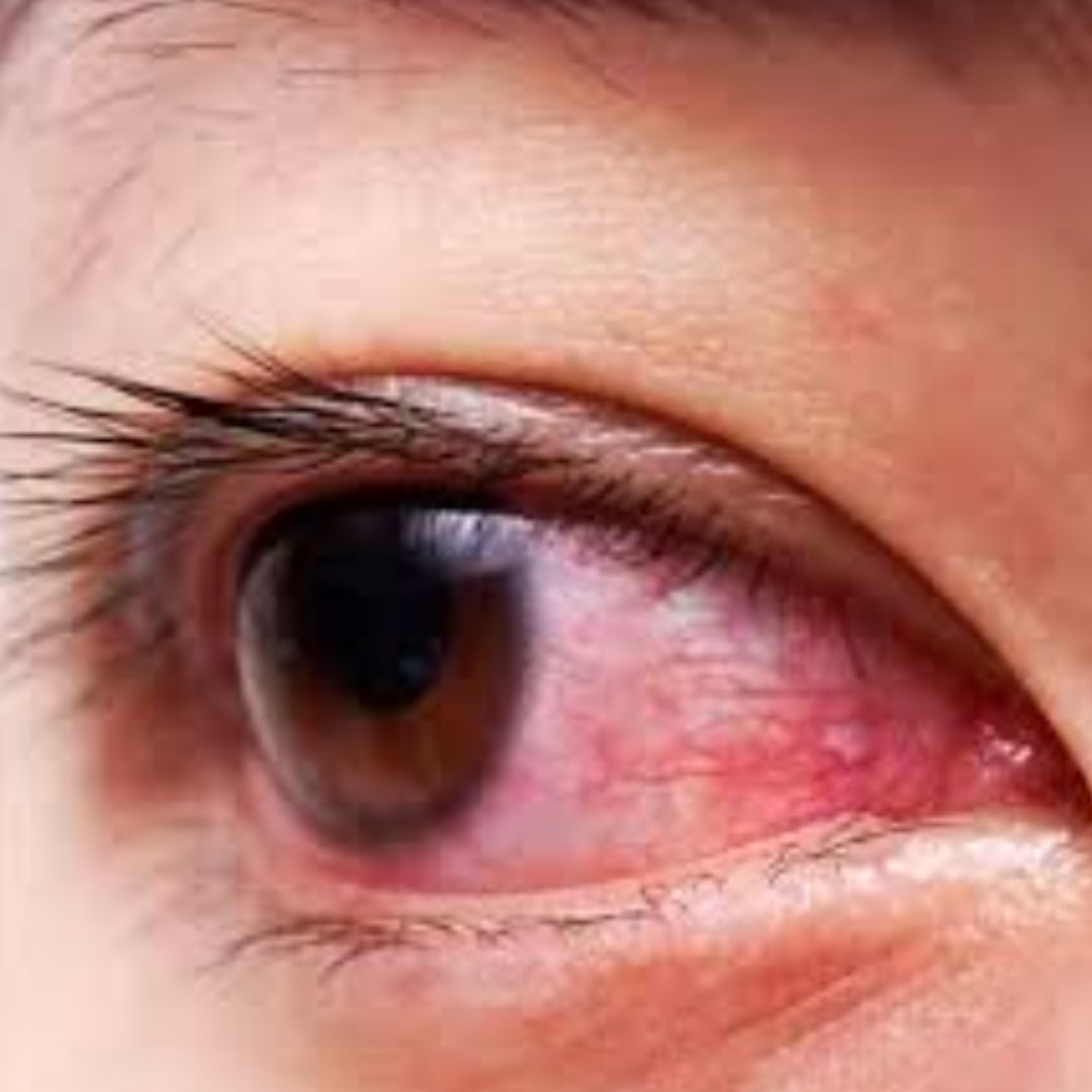 Vitreoretinal Services